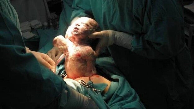 Se hacen más por la noche y pueden dañar la salud de los bebés, según un estudio
