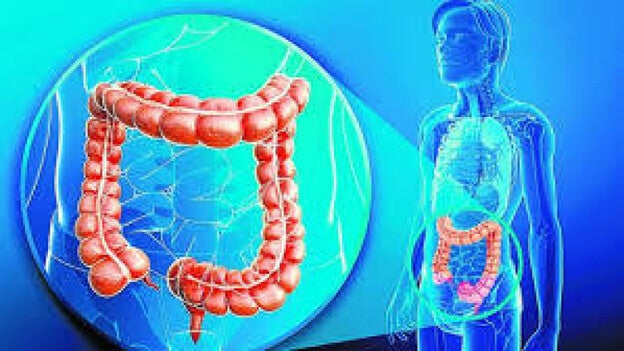 Médicos y pacientes piden un abordaje integral contra el Crohn y la colitis ulcerosa