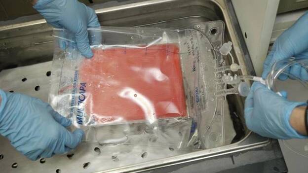 Canarias bate un récord histórico de donación de médula ósea