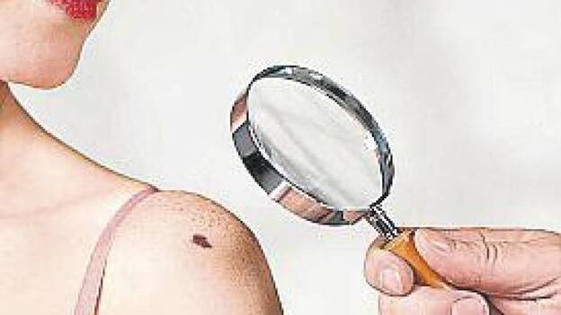 Cáncer, la supervivencia en 2030 solo será posible con una estrategia nacional