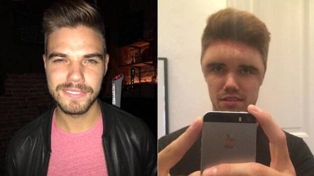 Un tinte le deforma la cabeza