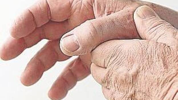 Artrosis, el número de afectados se ha doblado en 30 años y sigue en aumento