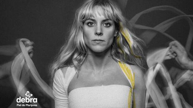 La piel de mariposa desnuda a los famosos