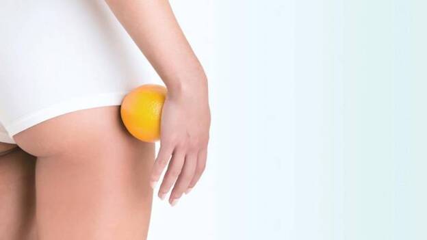 Diez mitos sobre la celulitis