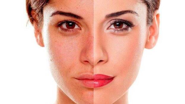 ¿Por qué envejece la piel?