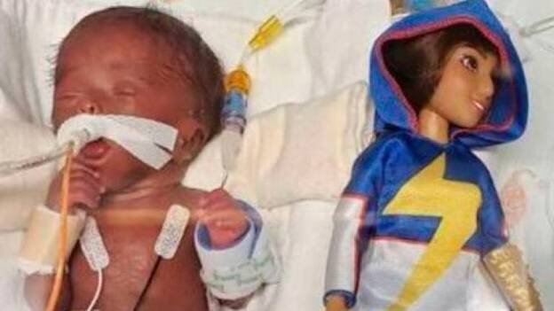 Sobrevive una niña más pequeña que una barbie