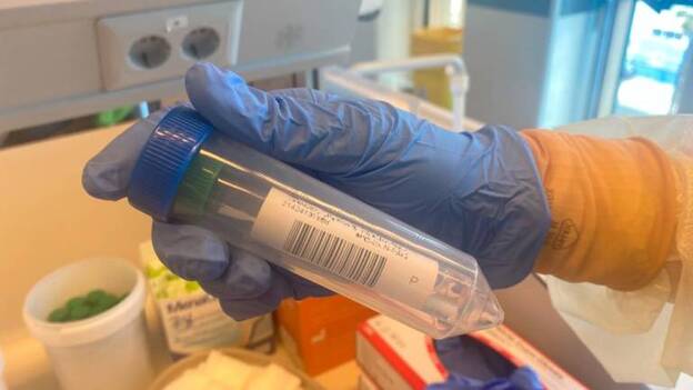 Sanidad realiza 29.000 pruebas PCR a su personal