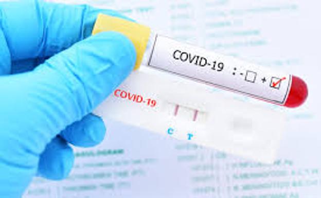Sanidad prácticamente duplica de julio a agosto el número de PCR para diagnóstico del virus