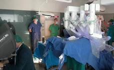 Canarias realiza con éxito su primera cirugía robótica de cáncer de vejiga