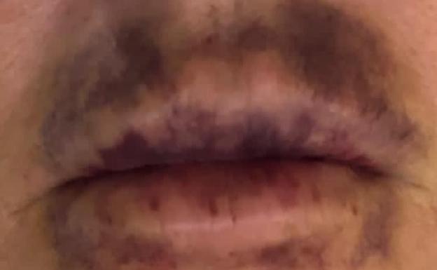 Detenido por distribuir un cosmético que provocó graves lesiones a 7 mujeres