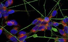 Los astrocitos explican por qué la covid provoca a veces trastornos neuronales