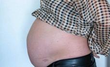 Lleva 10 años «embarazada» por no tratar una distensión del parto