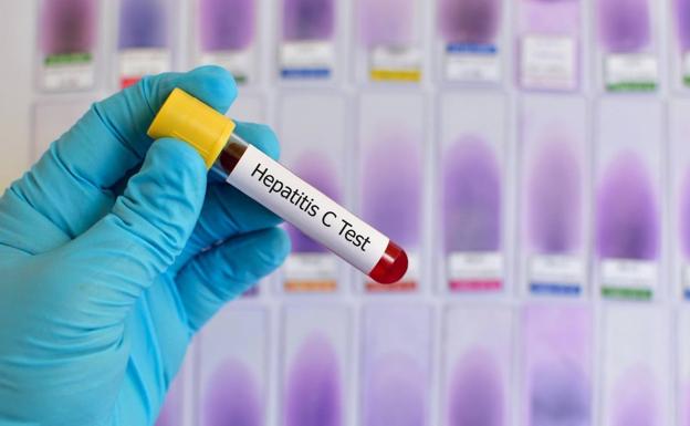 El 95% de los pacientes sometidos a los nuevos antivirales de acción directa supera la hepatitis C