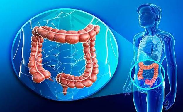 Aprueban la Proposición No de Ley a favor de los cribado de cáncer de colon