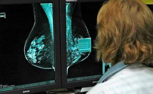 Ámate alerta sobre importantes retrasos en la atención al cáncer de mama