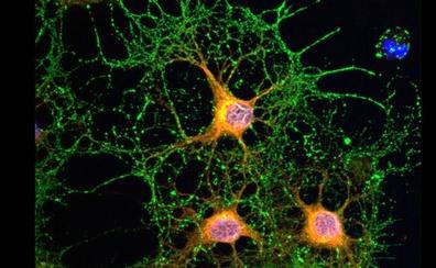 Descubren el mecanismo de estabilización de las neuronas