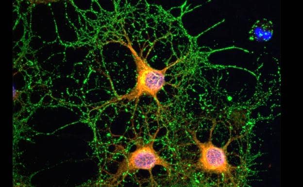 Descubren el mecanismo de estabilización de las neuronas