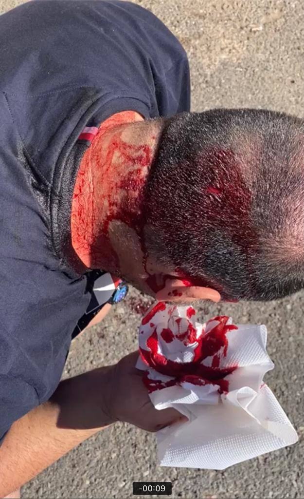 Agreden con bate de béisbol a un agente que medió fuera de servicio en una reyerta en Arinaga