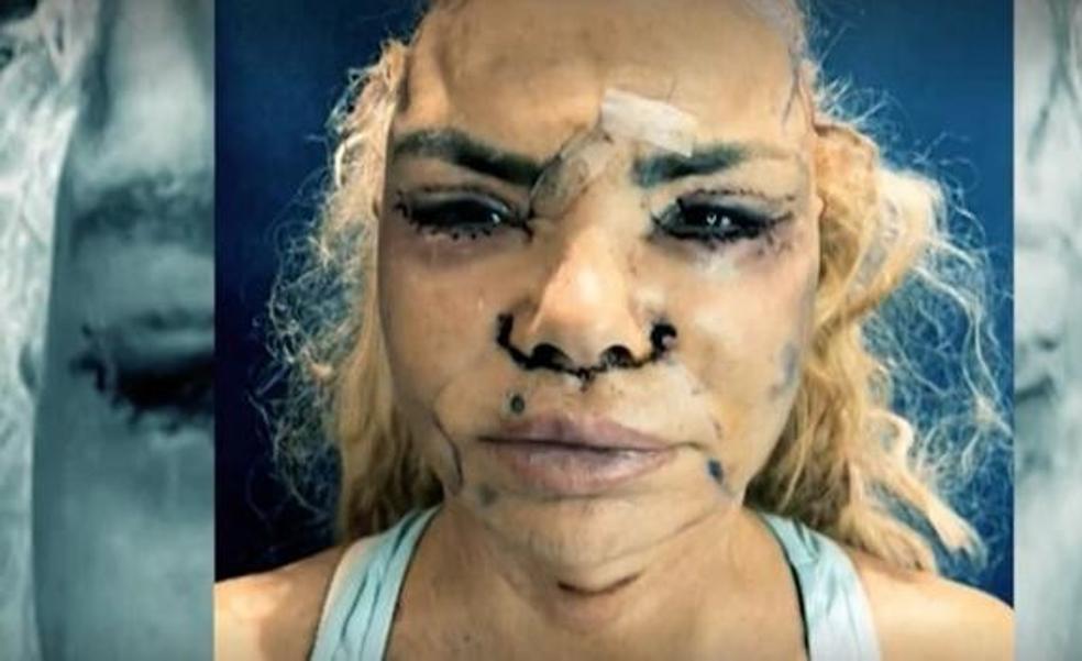 Así es la impactante imagen de Leticia Sabater tras una operación estética