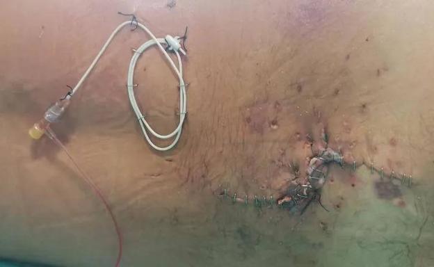 «Después de dispararme dos veces, fueron a rematarme», relata la víctima