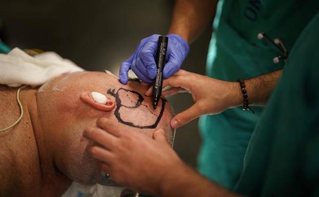 ¿Cómo conservar los idiomas en un cerebro políglota cuando se opera un tumor?