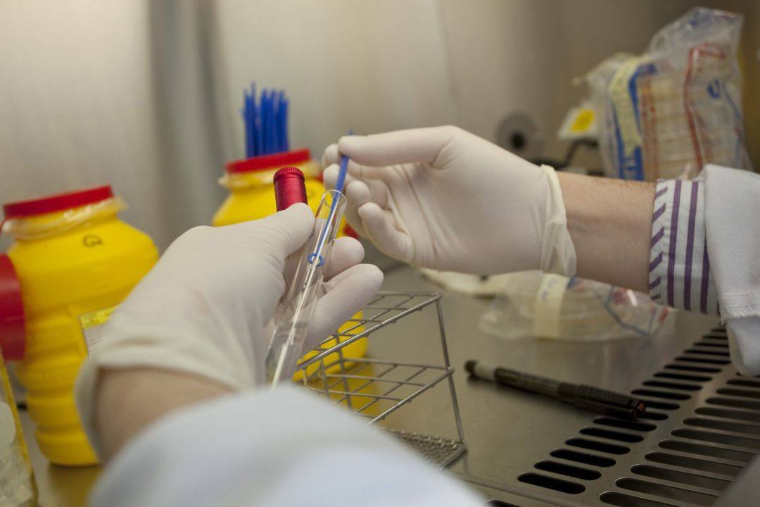 Sanidad notifica dos nuevos casos confirmados en Canarias de viruela del mono