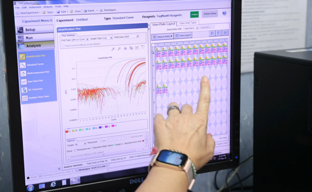Un bebé de 7 meses, contagiado de viruela del mono