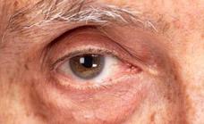 La calima puede agravar los síntomas del ojo seco