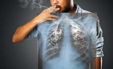 Cáncer de pulmón: buenas noticias desde la batalla para derrocar al emperador de los tumores