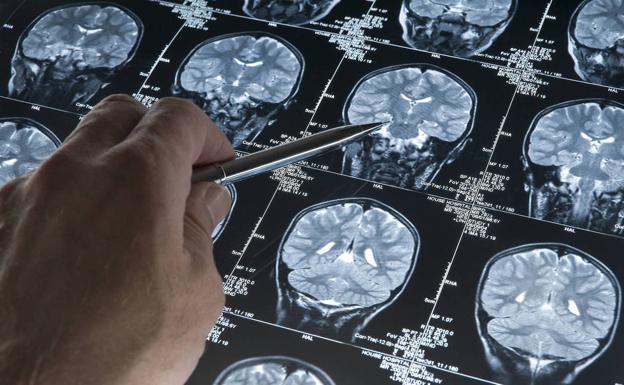 Mensajeros químicos al envejecer