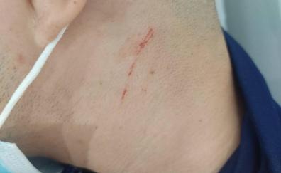 Un menor denuncia que fue agredido por agentes de la Policía Local en Santa Lucía