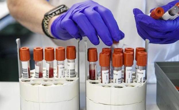 Una mujer elimina por primera vez el VIH por un trasplante de células madre